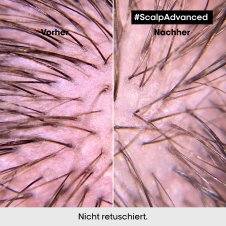LOréal Professionnel Serie Expert Scalp Advanced Anti-Discomfort Intense Soother Treatment 200ml Haarmaske